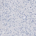 Immunohistochemical staining of human liver shows no positivity in hepatocytes as expected.