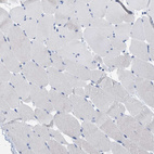 Immunohistochemical staining of human skeletal muscle shows no positivity in myocytes as expected.