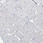 Immunohistochemical staining of human skeletal muscle shows no positivity in myocytes as expected.