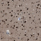 Immunohistochemical staining of human cerebral cortex shows strong positivity in neurons.