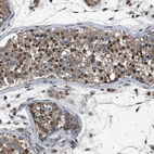 Immunohistochemical staining of human testis shows moderate positivity in cells in seminiferous ducts.
