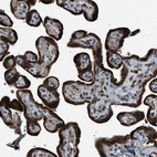 Immunohistochemical staining of human placenta shows strong positivity in trophoblastic cells.