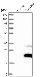 Western blot analysis in control (vector only transfected HEK293T lysate) and ZFAND2A over-expression lysate (Co-expressed with a C-terminal myc-DDK tag (~3.1 kDa) in mammalian HEK293T cells, LY405513).