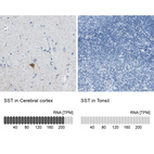 Anti-SST Antibody