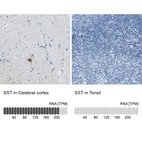 Anti-SST Antibody