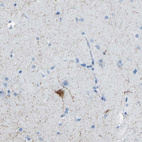 Immunohistochemical staining of human cerebral cortex shows moderate cytoplasmic positivity in neurons, as well as immunoreactivity in neural processes.