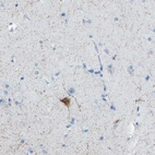Immunohistochemical staining of human cerebral cortex shows moderate cytoplasmic positivity in neurons, as well as immunoreactivity in neural processes.