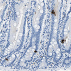 Immunohistochemical staining of human duodenum shows strong cytoplasmic positivity in neuroendocrine cells.