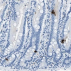 Immunohistochemical staining of human duodenum shows strong cytoplasmic positivity in neuroendocrine cells.