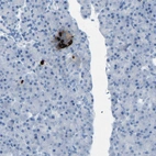Immunohistochemical staining of human pancreas shows strong cytoplasmic positivity in a subset of cells in islets of Langerhans.