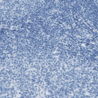Immunohistochemical staining of human tonsil shows no positivity in lymphoid cells as expected.