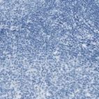 Immunohistochemical staining of human tonsil shows no positivity in lymphoid cells as expected.