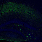 Immunofluorescence staining of mouse dentate gyrus shows moderate to strong positivity in a subset of neurons in the polymorph layer.