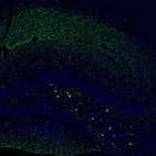 Immunofluorescence staining of mouse dentate gyrus shows moderate to strong positivity in a subset of neurons in the polymorph layer.