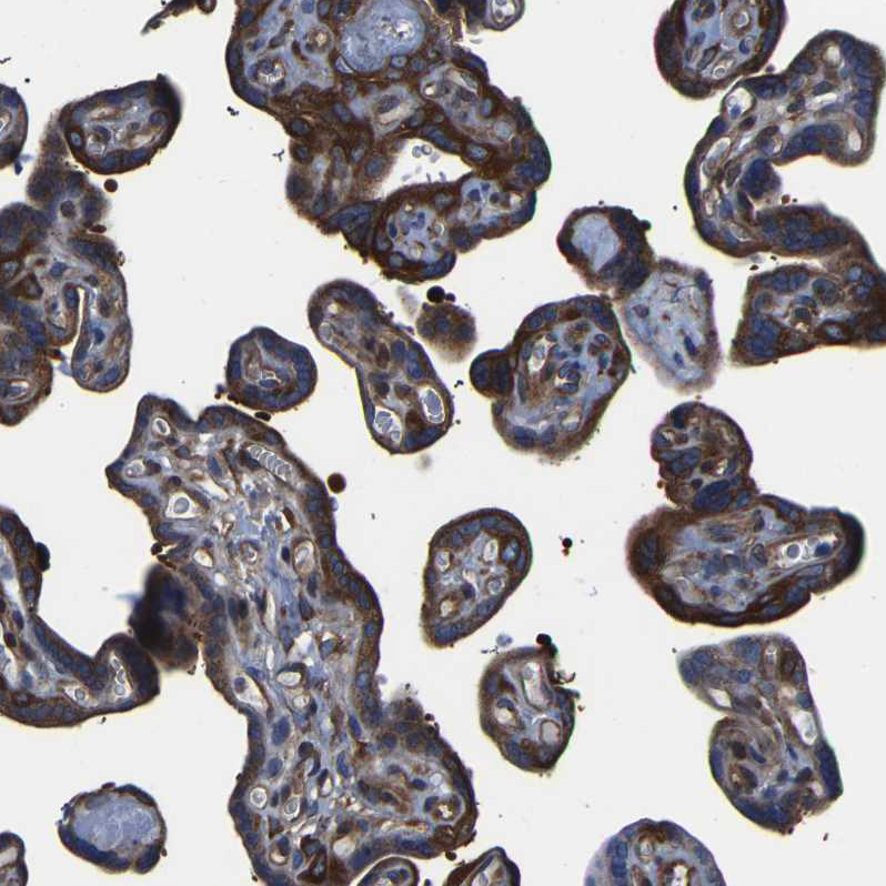 Anti-TFG Antibody