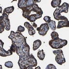 Anti-TFG Antibody