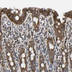Immunohistochemical staining of human rectum shows strong cytoplasmic positivity in glandular cells.