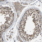 Immunohistochemical staining of human testis shows moderate cytoplasmic positivity in cells in seminiferous ducts.