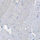 Immunohistochemical staining of human skeletal muscle shows no positivity in myocytes as expected.