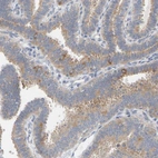 Anti-MINDY4 Antibody