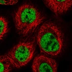 Immunofluorescent staining of human cell line A-431 shows localization to nuclear speckles.