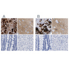 Immunohistochemical staining of human bronchus, cerebral cortex, colon and liver using Anti-HAPLN1 antibody HPA019482 (A) shows similar protein distribution across tissues to independent antibody HPA019105 (B).