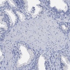 Immunohistochemical staining of human prostate shows low expression as expected.