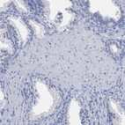 Immunohistochemical staining of human prostate shows low expression as expected.