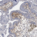 Immunohistochemical staining of human placenta shows high expression.