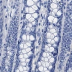 Immunohistochemical staining of human colon using Anti-HAPLN1 antibody HPA019482.