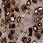 Immunohistochemical staining of human bronchus using Anti-HAPLN1 antibody HPA019482.