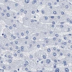 Immunohistochemical staining of human liver using Anti-HAPLN1 antibody HPA019482.