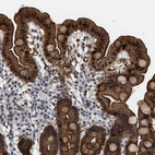 Anti-BAIAP2L1 Antibody