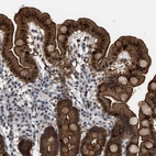 Immunohistochemical staining of human duodenum shows strong cytoplasmic and membranous positivity in glandular cells.