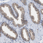 Anti-BAIAP2L1 Antibody