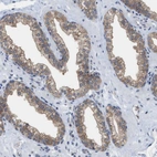 Immunohistochemical staining of human prostate shows weak cytoplasmic positivity in glandular cells.