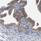 Immunohistochemical staining of human Fallopian tube shows weak cytoplasmic positivity in glandular cells.