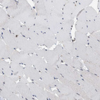Immunohistochemical staining of human skeletal muscle shows no positivity in myocytes as expected.