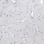 Immunohistochemical staining of human skeletal muscle shows no positivity in myocytes as expected.
