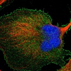 Anti-BAIAP2L1 Antibody