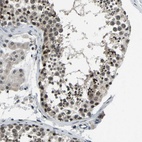 Immunohistochemical staining of human testis shows high expression.