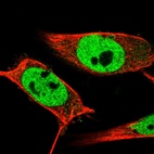 Immunofluorescent staining of human cell line U-251 MG shows localization to nucleoplasm.