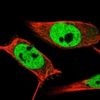 Immunofluorescent staining of human cell line U-251 MG shows localization to nucleoplasm.