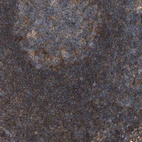 Immunohistochemical staining of human lymph node shows strong cytoplasmic positivity in non-germinal center cells.