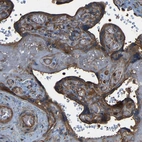 Immunohistochemical staining of human placenta shows strong granular cytoplasmic positivity in trophoblastic cells.