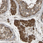 Immunohistochemical staining of human testis shows strong cytoplasmic positivity in Leydig cells.