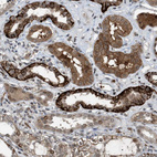 Immunohistochemical staining of human kidney shows strong membranous and cytoplasmic positivity in cells in tubules.