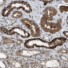 Immunohistochemical staining of human kidney shows strong membranous and cytoplasmic positivity in cells in tubules.