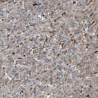 Anti-RFFL Antibody