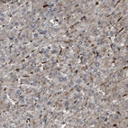 Immunohistochemical staining of human liver shows moderate membranous and cytoplasmic positivity in hepatocytes.